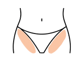 Linea bikini